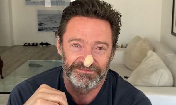 El actor subió un video a sus redes sociales donde comentó que prefiere dar detalles de su salud para evitar especulaciones sobre su apariencia actual.
