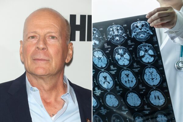 Duro deterioro de salud de Bruce Willis: ya no puede hablar, leer ni caminar